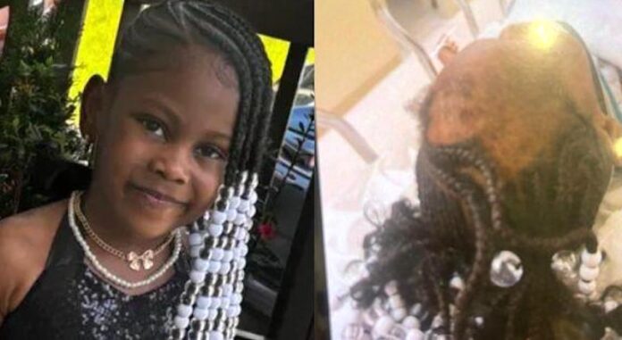 La madre declaró que los agresores de su hija le arrancaron el cuero cabelludo.